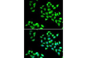 Immunofluorescence analysis of HeLa cell using NNMT antibody. (NNMT antibody)