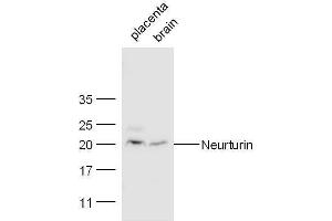 Mouse placenta and heart lysates probed with Rabbit Anti-Neurturin Polyclonal Antibody, Unconjugated  at 1:500 for 90 min at 37˚C. (Neurturin antibody  (AA 151-197))