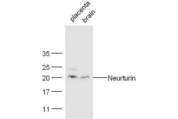 Neurturin 抗体  (AA 151-197)
