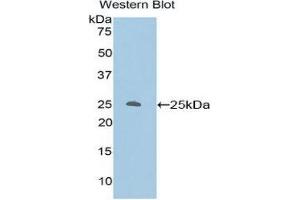 Western Blotting (WB) image for anti-Protein Kinase C, zeta (PRKCZ) (AA 404-591) antibody (ABIN1860239) (PKC zeta antibody  (AA 404-591))