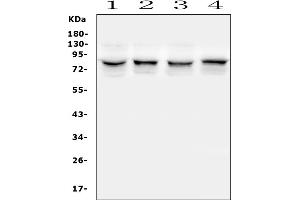 Western blot analysis of TRPV5 using anti-TRPV5 antibody (ABIN7600034).