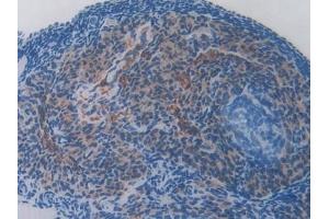 Immunohistochemistry (IHC) image for anti-Ferritin, Mitochondrial (FTMT) (AA 54-229) antibody (ABIN7437572)