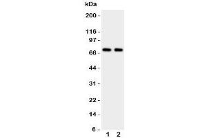 Western blot testing of Prolactin Receptor antibody and Lane 1:  HeLa;  2: MCF-7 cell lysate (Prolactin Receptor antibody  (C-Term))