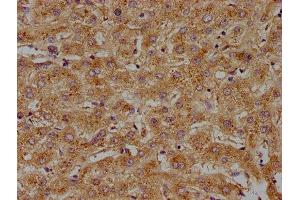 IHC image of ABIN7143238 diluted at 1:100 and staining in paraffin-embedded human liver tissue performed on a Leica BondTM system.