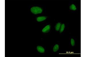 Immunofluorescence of purified MaxPab antibody to ZNF133 on HeLa cell. (ZNF133 antibody  (AA 1-653))