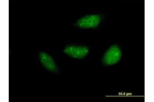Immunofluorescence of purified MaxPab antibody to NOL6 on HeLa cell. (Nucleolar Protein 6 antibody  (AA 1-200))