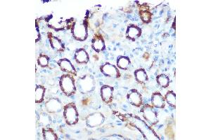 Immunohistochemistry (IHC) image for anti-Lon Peptidase 1, Mitochondrial (LONP1) (AA 120-400) antibody (ABIN1680707)