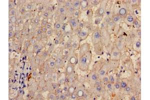 Immunohistochemistry of paraffin-embedded human liver tissue using ABIN7154060 at dilution of 1:100 (GGT1 antibody  (AA 13-225))