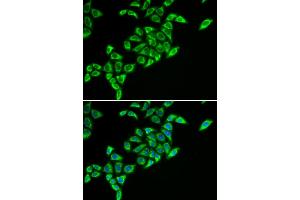 Immunofluorescence analysis of HeLa cells using DLAT antibody. (DLAT antibody)