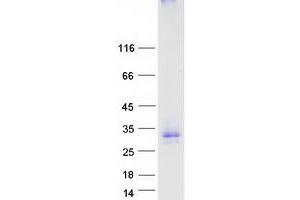 Validation with Western Blot (GPM6A Protein (Transcript Variant 3) (Myc-DYKDDDDK Tag))