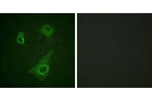 P-peptide - +Western blot analysis of extracts from K562 cells, using Epo-R (Phospho-Tyr368) antibody. (EPOR antibody  (pTyr368))