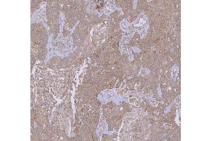 IHC analysis of WDR44 using anti-WDR44 antibody (ABIN7600394). (WDR44 antibody  (AA 188-913))