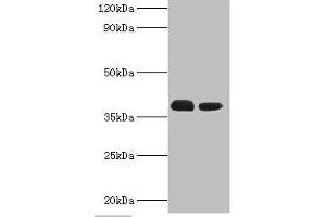 Western blot All lanes: Three-prime repair exonuclease 1 antibody at 3 μg/mL Lane 1: Hela whole cell lysate Lane 2: HepG2 whole cell lysate Secondary Goat polyclonal to rabbit IgG at 1/10000 dilution Predicted band size: 39, 33, 34 kDa Observed band size: 39 kDa (TREX1 antibody  (AA 1-270))
