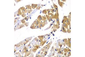 Immunohistochemistry of paraffin-embedded mouse heart using PPP1R12A Antibody (ABIN5974045) at dilution of 1/100 (40x lens).