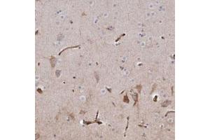 Immunohistochemical staining (Formalin-fixed paraffin-embedded sections) of human cerebral cortex with SEMA3E polyclonal antibody  shows staining in blood vessels and moderate positivity in neurons. (SEMA3E antibody)