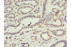 Immunohistochemistry (IHC) image for anti-Death-Associated Protein Kinase 2 (DAPK2) (AA 222-370) antibody (ABIN7149554)