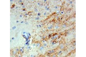 IHC-P analysis of Brain tissue, with DAB staining. (INHBB antibody  (AA 50-404))