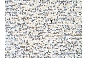 GAPVD1 antibody was used for immunohistochemistry at a concentration of 4-8 ug/ml to stain Neural cells (arrows) in Human Brain. (GAPVD1 antibody  (N-Term))