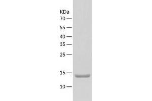 Western Blotting (WB) image for Chemokine (C-C Motif) Ligand 25 (CCL25) (AA 24-144) protein (His tag) (ABIN7122292) (CCL25 Protein (AA 24-144) (His tag))