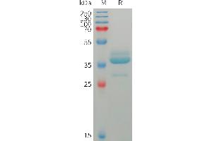 Trefoil Factor 1 (TFF1) (AA 25-84) protein (Fc Tag)