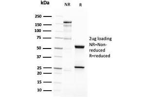 SDS-PAGE (SDS) image for anti-CD63 (CD63) (AA 100-197) antibody (ABIN6941235)