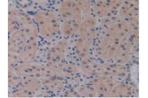 Detection of IL17RE in Rat Kidney Tissue using Polyclonal Antibody to Interleukin 17 Receptor E (IL17RE) (IL17RE antibody  (AA 457-626))