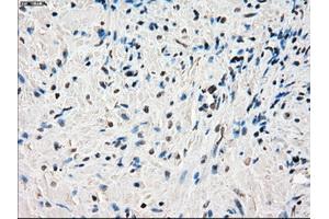 Immunohistochemical staining of paraffin-embedded endometrium tissue using anti-PORmouse monoclonal antibody. (POR antibody)