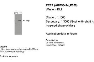 Western Blotting (WB) image for anti-Prolyl Endopeptidase (PREP) (Middle Region) antibody (ABIN2786689) (PREP antibody  (Middle Region))
