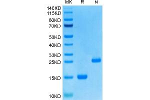 GDF15 Protein (AA 197-308) (His tag)
