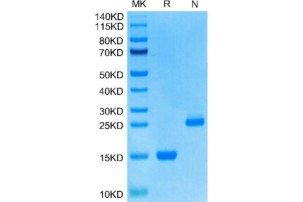 GDF15 Protein (AA 197-308) (His tag)