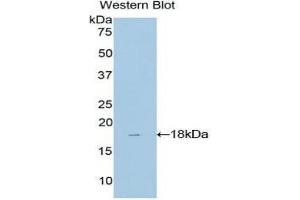 Western Blotting (WB) image for anti-TAF13 RNA Polymerase II, TATA Box Binding Protein (TBP)-Associated Factor, 18kDa (TAF13) (AA 1-124) antibody (ABIN1860676) (TAF13 antibody  (AA 1-124))