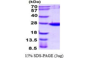 ADP-Ribosylation Factor-Like 14 (ARL14) (AA 1-192) protein (His tag)