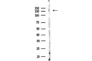 Western blot analysis of lysates from COLO205 cells(UV,30 min treatment), using CLIP1 Antibody at 1/1000 dilution.