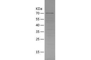 Western Blotting (WB) image for Cereblon (CRBN) (AA 1-442) protein (His-IF2DI Tag) (ABIN7288453) (CRBN Protein (AA 1-442) (His-IF2DI Tag))