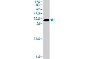 Western Blot detection against Immunogen (31. (ENO3 antibody  (AA 228-277))