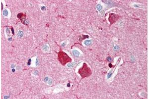 Human Brain, Cortex (formalin-fixed, paraffin-embedded) stained with NGFR antibody ABIN214454 at 5 ug/ml followed by biotinylated goat anti-rabbit IgG secondary antibody ABIN481713, alkaline phosphatase-streptavidin and chromogen. (NGFR antibody)