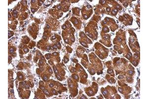 IHC-P Image Immunohistochemical analysis of paraffin-embedded human hepatoma, using ANGPTL3, antibody at 1:500 dilution. (ANGPTL3 antibody)