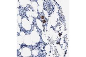Immunohistochemical staining of human bone marrow with TREML1 polyclonal antibody  shows strong cytoplasmic positivity in megakaryocytes of bone marrow poietic cells.