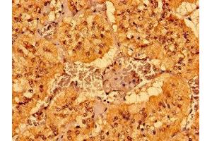 Immunohistochemistry of paraffin-embedded human adrenal gland tissue using ABIN7158957 at dilution of 1:100 (MCAT antibody  (AA 22-117))