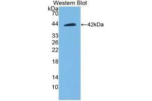 Detection of Recombinant BECN1, Rat using Polyclonal Antibody to Beclin 1 (BECN1) (Beclin 1 antibody)