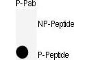 Dot blot analysis of anti-CDK11-S39 Phospho-specific Pab (ABIN389538 and ABIN2839585) on nitrocellulose membrane. (CDK1 antibody  (pSer39))