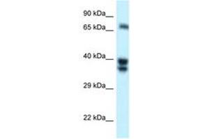 Image no. 1 for anti-SH3-Domain Binding Protein 1 (SH3BP1) (AA 125-174) antibody (ABIN6747750) (SH3BP1 antibody  (AA 125-174))