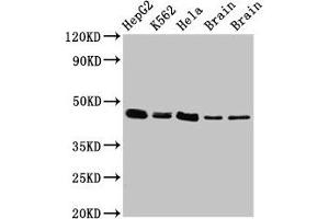 Western Blot Positive WB detected in: HepG2 whole cell lysate, K562 whole cell lysate, Hela whole cell lysate, Rat brain tissue, Mouse brain tissue All lanes: FLOT1 antibody at 3 μg/mL Secondary Goat polyclonal to rabbit IgG at 1/50000 dilution Predicted band size: 48, 43 kDa Observed band size: 48 kDa (Flotillin 1 antibody  (AA 169-251))