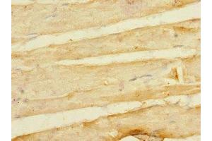 Immunohistochemistry of paraffin-embedded human skeletal muscle tissue using ABIN7158373 at dilution of 1:100 (LIM Domain Binding 3 Protein antibody  (AA 1-283))