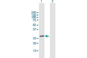 GLIPR1L2 antibody  (AA 1-253)