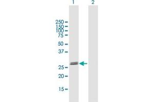 Western Blot analysis of GLIPR1L2 expression in transfected 293T cell line by GLIPR1L2 MaxPab polyclonal antibody.