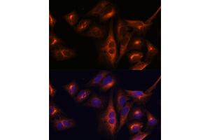 Immunofluorescence analysis of U-2 OS cells using Osteocalcin antibody (ABIN6134565, ABIN6137546, ABIN6137547 and ABIN6221793) at dilution of 1:100. (Osteocalcin antibody  (AA 1-100))