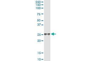 Immunoprecipitation of C4orf43 transfected lysate using anti-C4orf43 MaxPab rabbit polyclonal antibody and Protein A Magnetic Bead , and immunoblotted with C4orf43 purified MaxPab mouse polyclonal antibody (B01P) . (C4orf43 antibody  (AA 1-203))