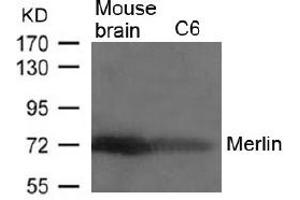 Image no. 2 for anti-Neurofibromin 2 (NF2) (AA 516-520) antibody (ABIN197520) (Merlin antibody  (AA 516-520))