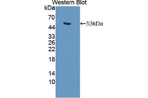 Western blot analysis of the recombinant protein. (Keratin 25 antibody  (AA 1-446))